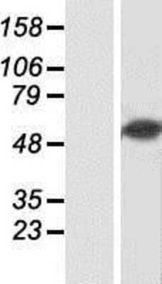 Western Blot: csl/RBPJK Overexpression Lysate [NBP2-04570]