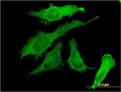 Immunocytochemistry/ Immunofluorescence: RBPMS Antibody (1C12) [H00011030-M03]
