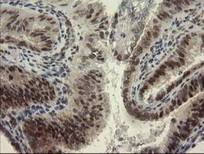Immunohistochemistry: RBPMS Antibody (OTI2G10) [NBP2-45551]