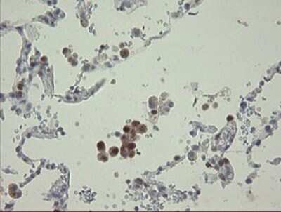 Immunohistochemistry: RBPMS Antibody (OTI2G10) [NBP2-45551]