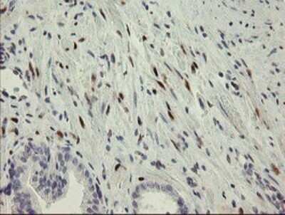Immunohistochemistry: RBPMS Antibody (OTI2G10) [NBP2-45551]