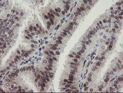 Immunohistochemistry-Paraffin: RBPMS Antibody (OTI3B7) [NBP2-03905]