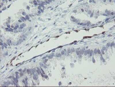 Immunohistochemistry-Paraffin: RBPMS Antibody (OTI3B7) [NBP2-03905]