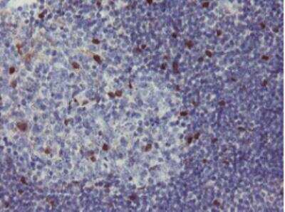 Immunohistochemistry-Paraffin: RBPMS Antibody (OTI3B7) [NBP2-03905]