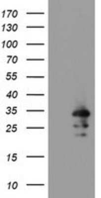 Western Blot: RBPMS Antibody (OTI3B7) [NBP2-03905]