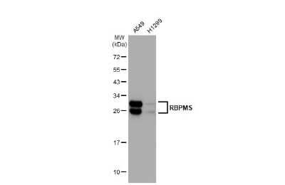 Western Blot: RBPMS Antibody (HL1105) [NBP3-13722]