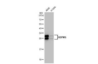 Western Blot: RBPMS Antibody (HL1106) [NBP3-13723]