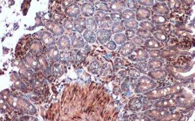 Immunohistochemistry-Paraffin: RBPMS Antibody [NBP2-20112]