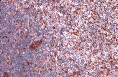 Immunohistochemistry-Paraffin: RBPMS Antibody [NBP2-20112]