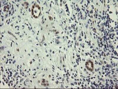 Immunohistochemistry: RBPMS Antibody (OTI2G10) - Azide and BSA Free [NBP2-73835]