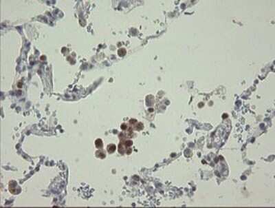 Immunohistochemistry: RBPMS Antibody (OTI2G10) - Azide and BSA Free [NBP2-73835]