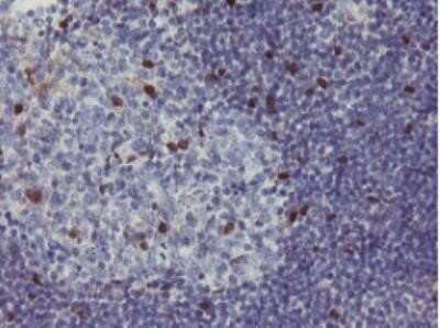 Immunohistochemistry: RBPMS Antibody (OTI3B7) - Azide and BSA Free [NBP2-73836]