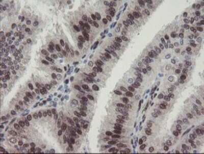 Immunohistochemistry: RBPMS Antibody (OTI3B7) - Azide and BSA Free [NBP2-73836]