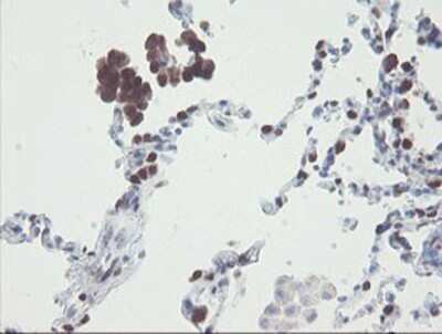 Immunohistochemistry: RBPMS Antibody (OTI3B7) - Azide and BSA Free [NBP2-73836]
