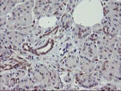 Immunohistochemistry: RBPMS Antibody (OTI3B7) - Azide and BSA Free [NBP2-73836]