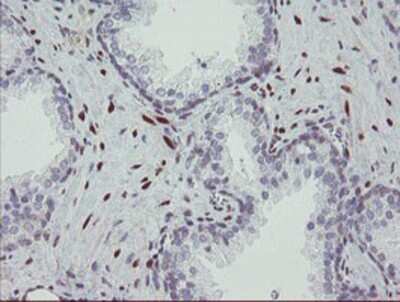 Immunohistochemistry: RBPMS Antibody (OTI3B7) - Azide and BSA Free [NBP2-73836]