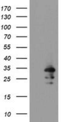 Western Blot: RBPMS Antibody (OTI3B7)Azide and BSA Free [NBP2-73836]