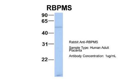 Western Blot: RBPMS Antibody [NBP1-57483]