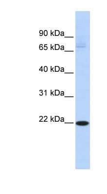 Western Blot: RBPMS2 Antibody [NBP1-57399]