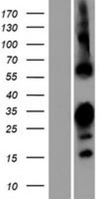 Western Blot: RBPMS2 Overexpression Lysate [NBP2-04752]