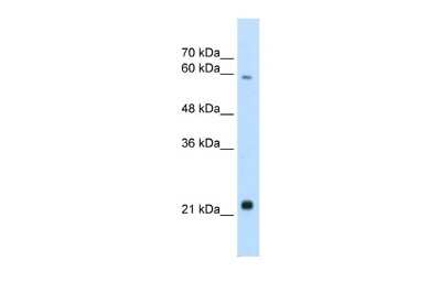 Western Blot: RBPSUHL Antibody [NBP2-84239]