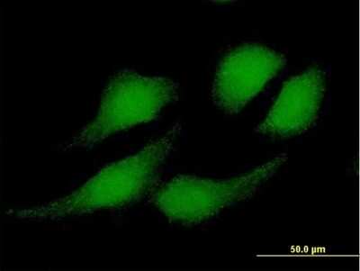 Immunocytochemistry/ Immunofluorescence: RBX1 Antibody [H00009978-B01P]