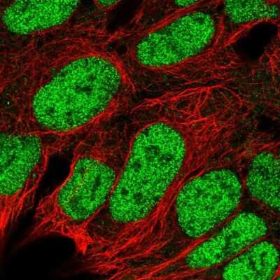 Immunocytochemistry/ Immunofluorescence: RBX1 Antibody [NBP1-88742]