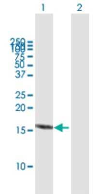 Western Blot: RBX1 Antibody [H00009978-B01P]