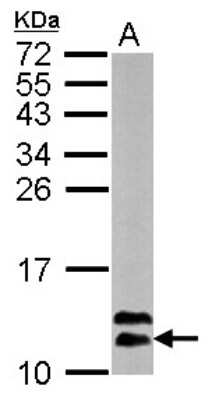 Western Blot: RBX1 Antibody [NBP2-20113]