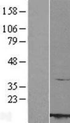 Western Blot: RBX1 Overexpression Lysate [NBL1-15236]