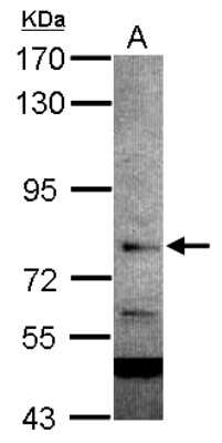 Western Blot: RC74 Antibody [NBP2-20114]