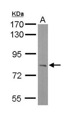 Western Blot: RC74 Antibody [NBP2-20114]