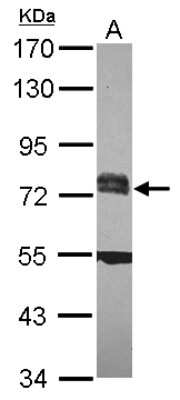 Western Blot: RC74 Antibody [NBP2-20115]