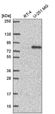 Western Blot: RC74 Antibody [NBP2-57534]