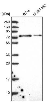 Western Blot: RC74 Antibody [NBP2-58713]