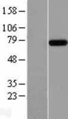 Western Blot: RC74 Overexpression Lysate [NBL1-12012]