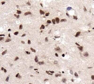Immunohistochemistry: RCAN1 Antibody - BSA Free [NBP1-46852]