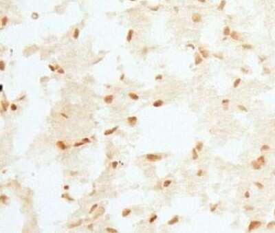 Immunohistochemistry: RCAN1 Antibody - BSA Free [NBP1-46853]