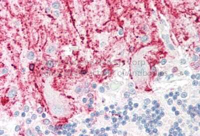 Immunohistochemistry-Paraffin: RCAN1 Antibody [NBP2-86770]