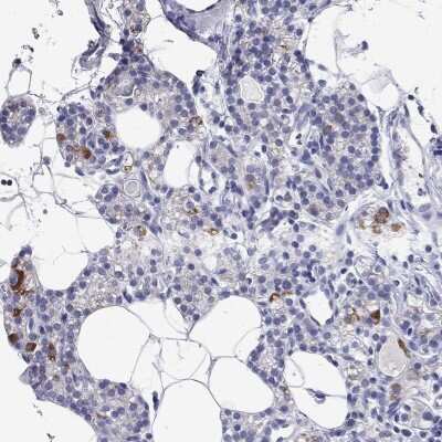 Immunohistochemistry-Paraffin: RCAN1 Antibody [NBP3-16971]