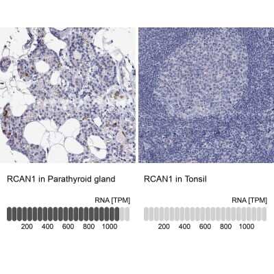 Immunohistochemistry-Paraffin: RCAN1 Antibody [NBP3-16971]