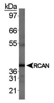 Western Blot: RCAN1 AntibodyBSA Free [NBP1-46852]