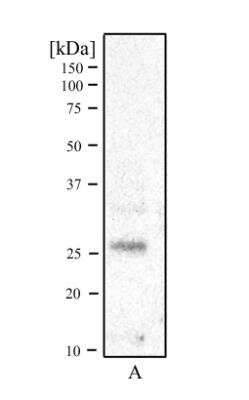 Western Blot: RCAN1 AntibodyBSA Free [NBP1-46852]