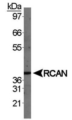 Western Blot: RCAN1 AntibodyBSA Free [NBP1-46853]