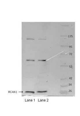 Western Blot: RCAN1 Antibody [NBP2-86769]