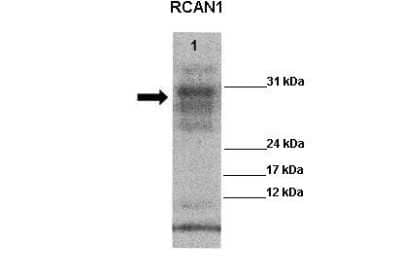 Western Blot: RCAN1 Antibody [NBP2-86769]
