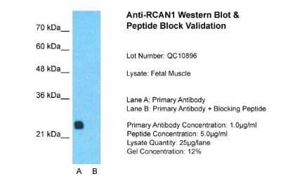 Western Blot: RCAN1 Antibody [NBP2-86769]