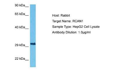 Western Blot: RCAN1 Antibody [NBP2-86769]