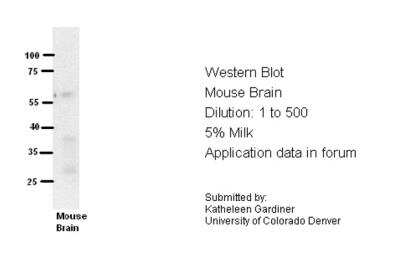 Western Blot: RCAN1 Antibody [NBP2-86769]