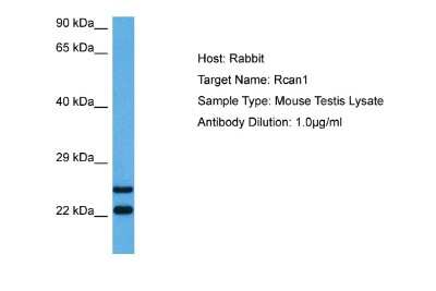 Western Blot: RCAN1 Antibody [NBP2-86771]